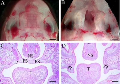 Novel investigations in retinoic-acid-induced cleft palate about the gut microbiome of pregnant mice